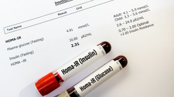 HOMA (Homeostatis Model Assessment) Index oder HOMA-IR Test zur Diagnose einer Insulinresistenz.